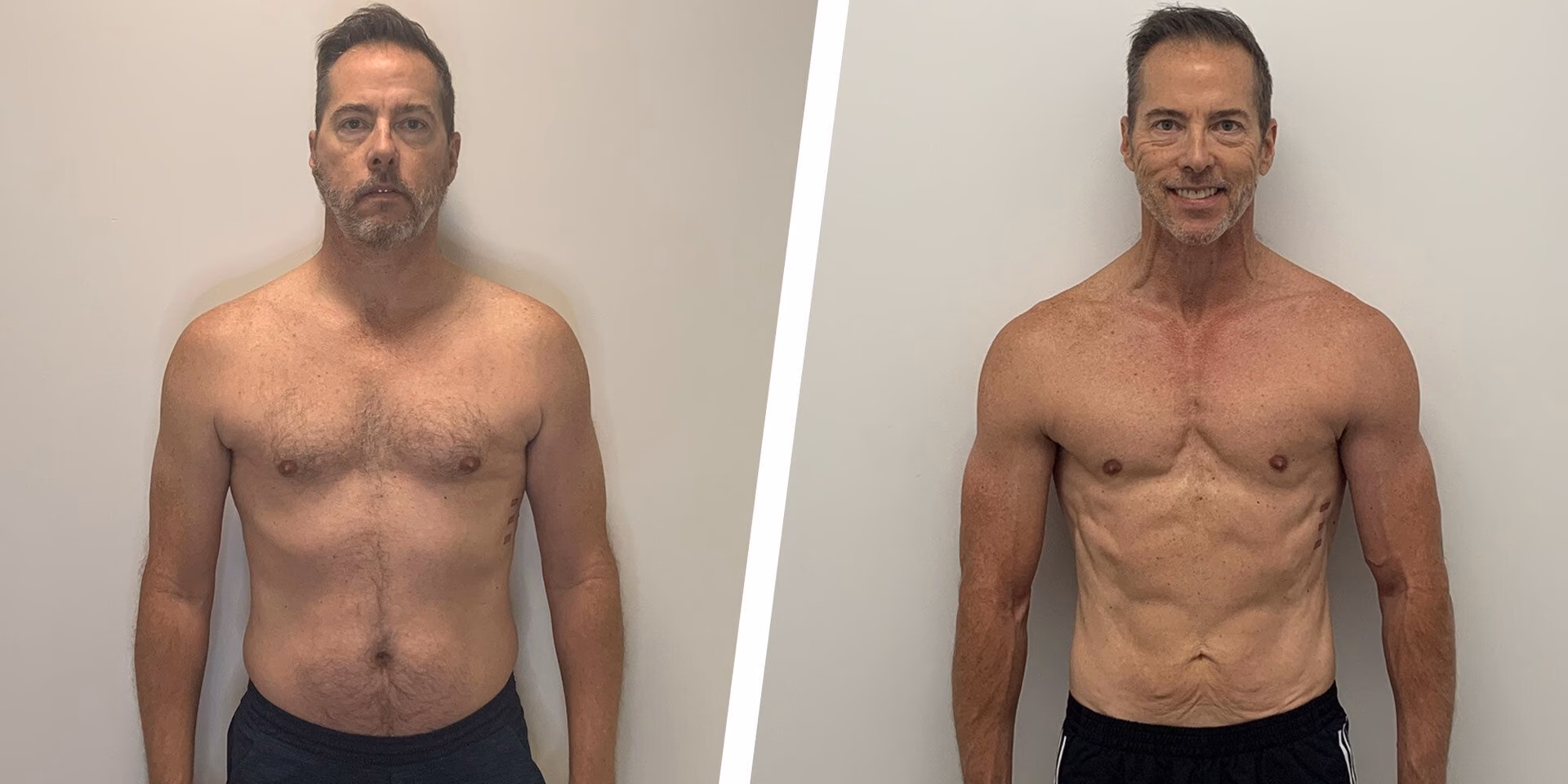 Do you have to pay for a garage service in Isle of Wight?