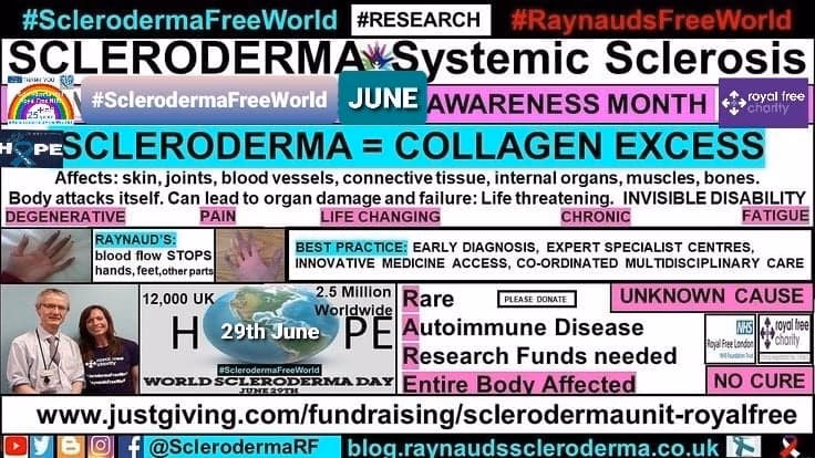 What is secondary Raynaud's & scleroderma?