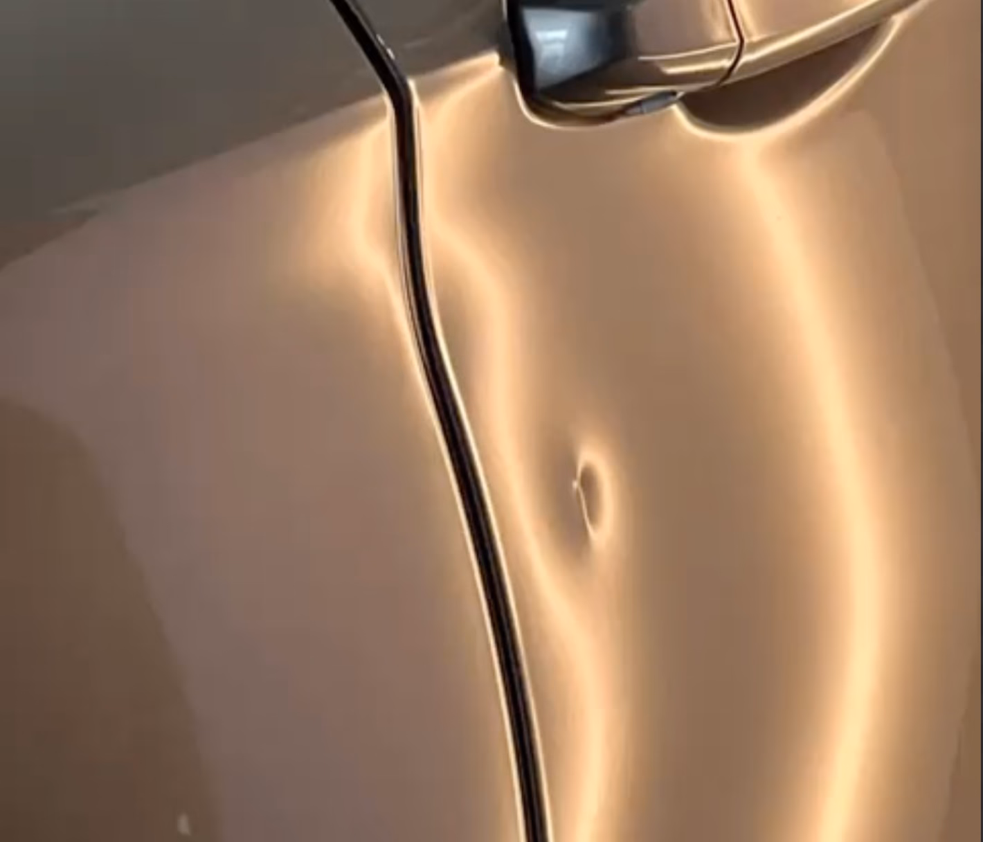 How much does a Dents repair cost?