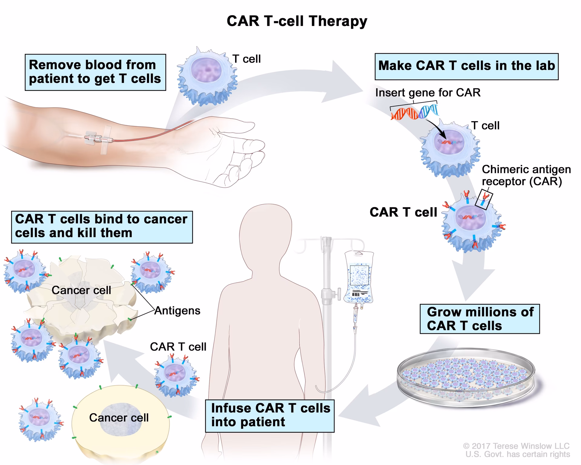 Where can I get CAR-T therapy in Cheshire & Merseyside?