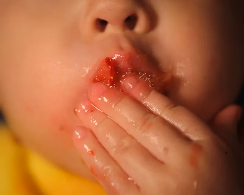 What if my child has swallowed a harmless object?