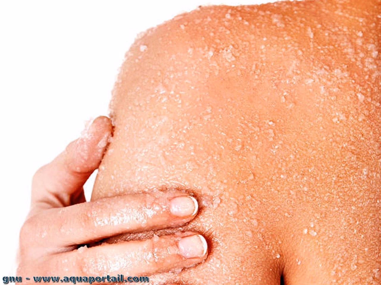 Qu'est-ce que le prurit et la desquamation ?