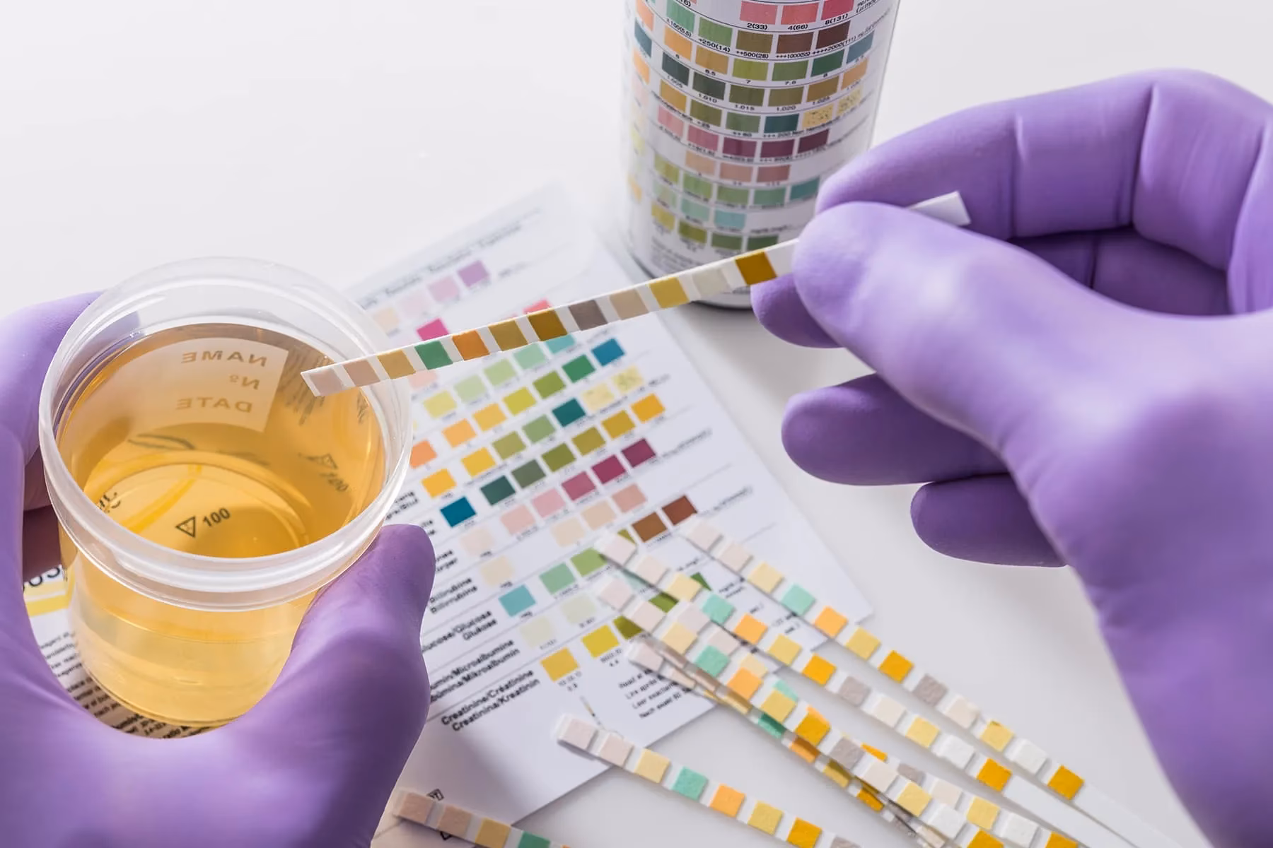Does CBD appear in a urine drug test?