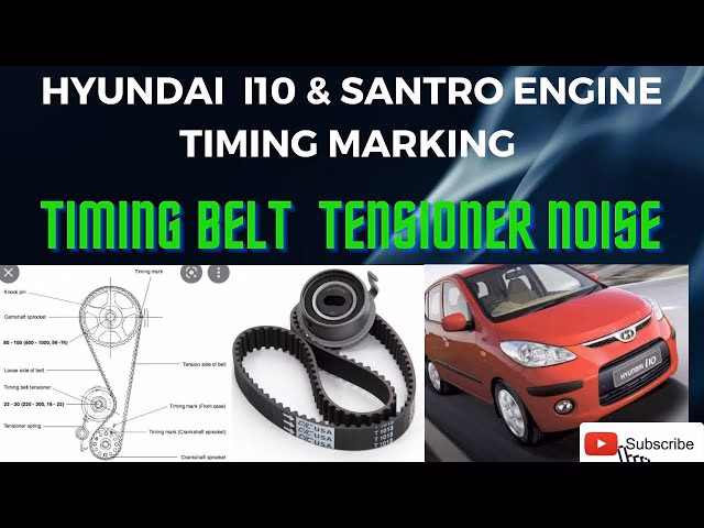 Does the Hyundai i10 have a handbrake?