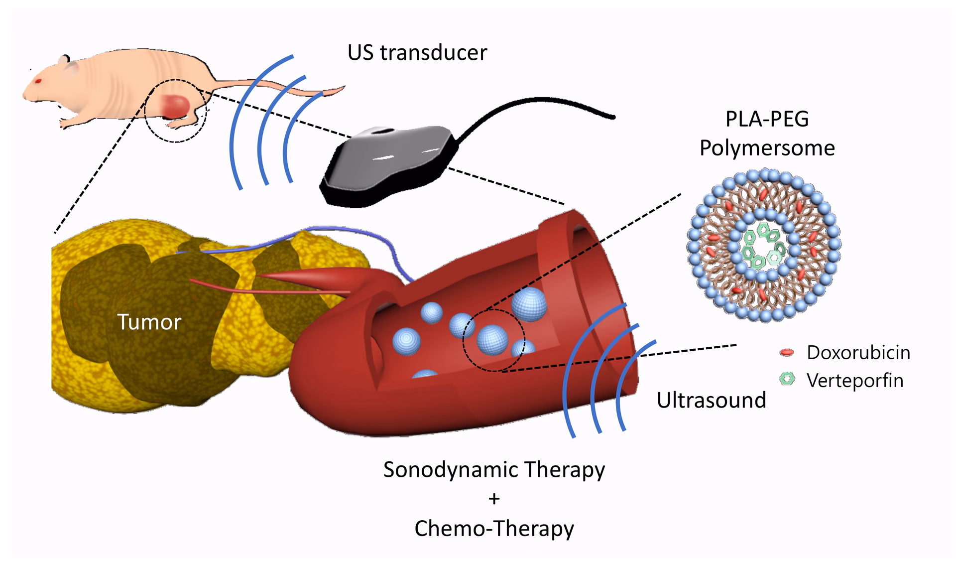 Can polymersomes be used in cancer therapy?