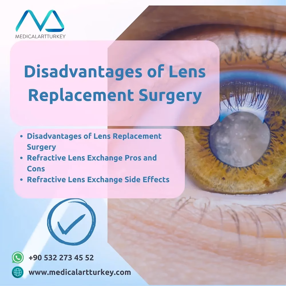 Is lens replacement surgery safe?