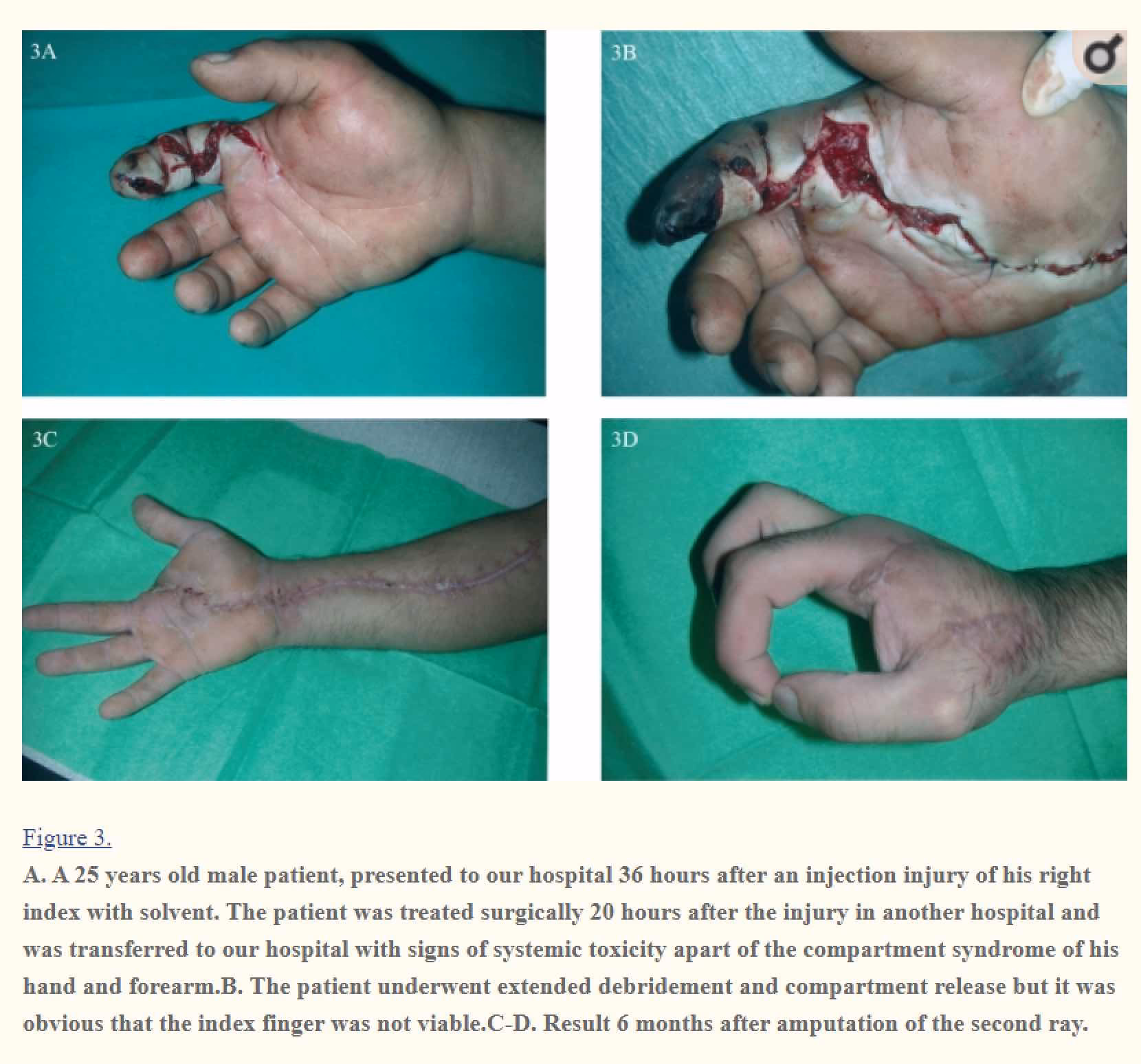 Can high-pressure equipment cause fluid injection injuries?