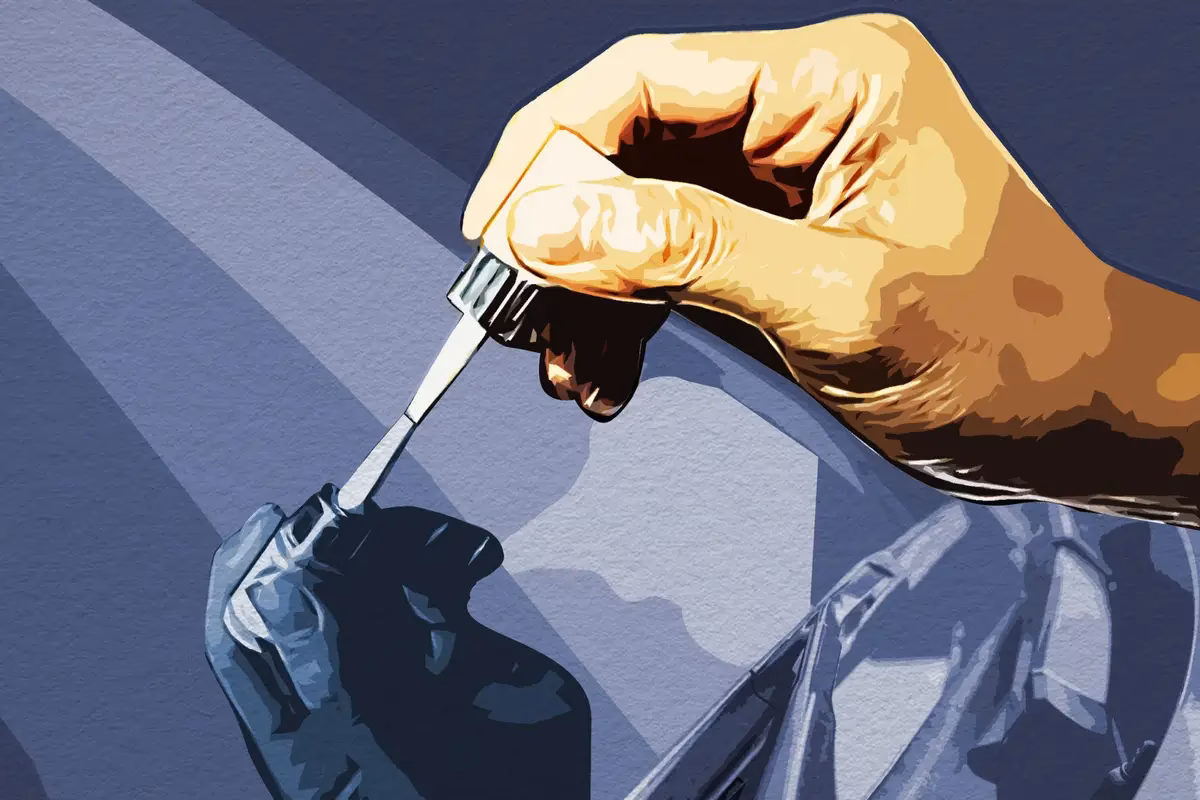 What are the benefits of fixing a cracked windshield?