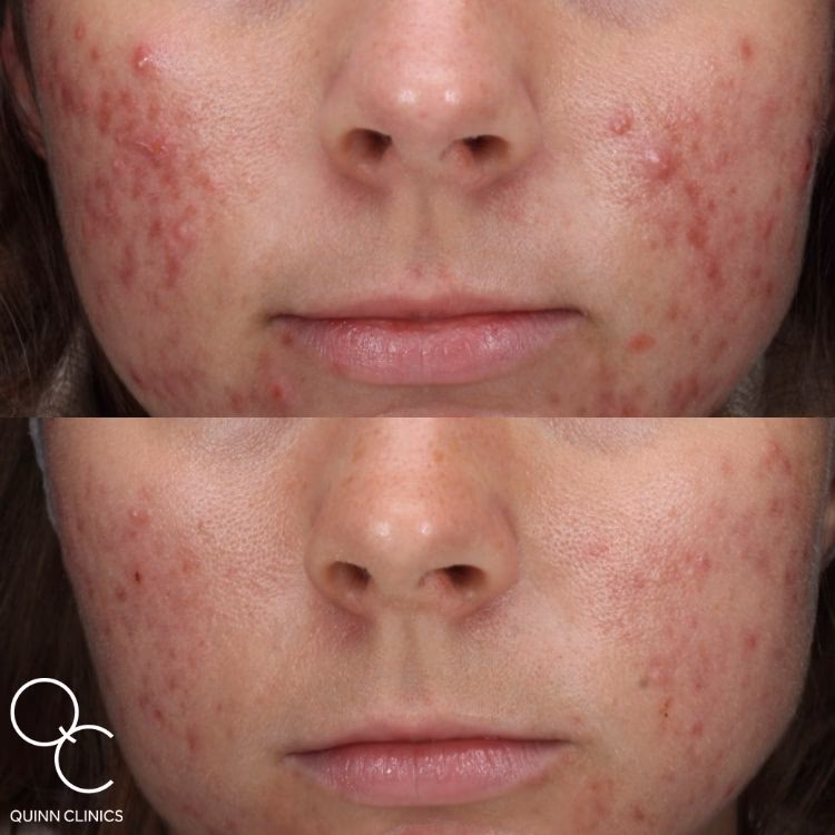 What can Laser Clinics UK do for You?