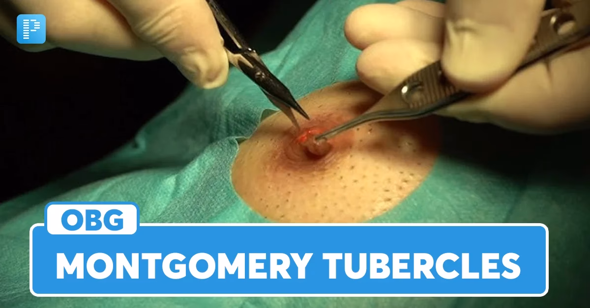 Are Montgomery's tubercles normal during pregnancy?
