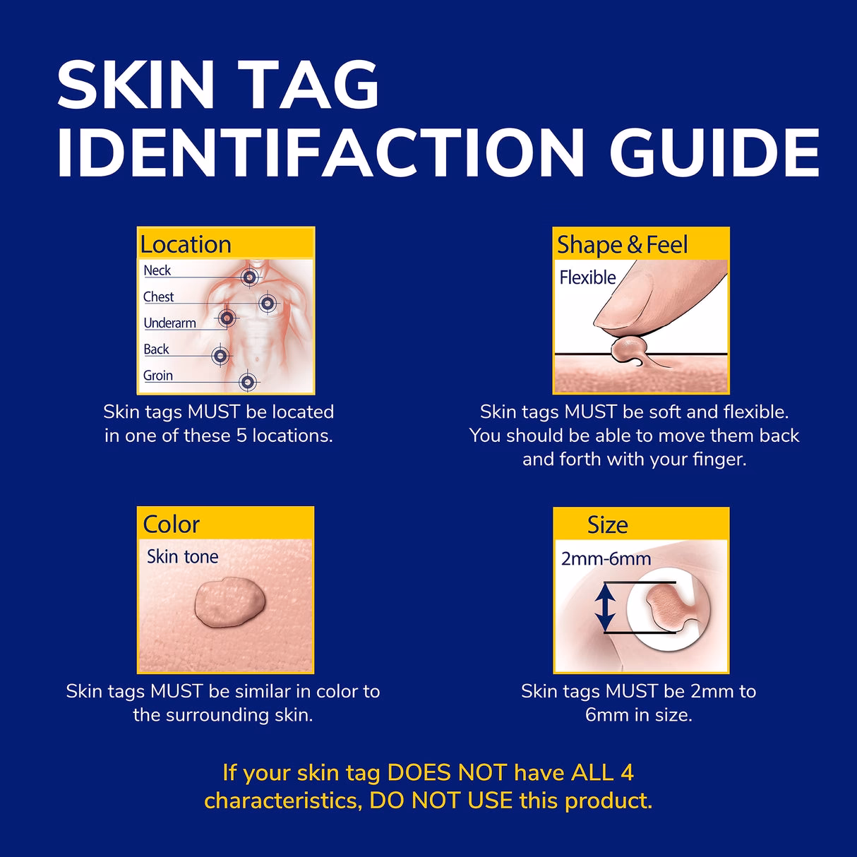 What is the best skin tag remover cream?