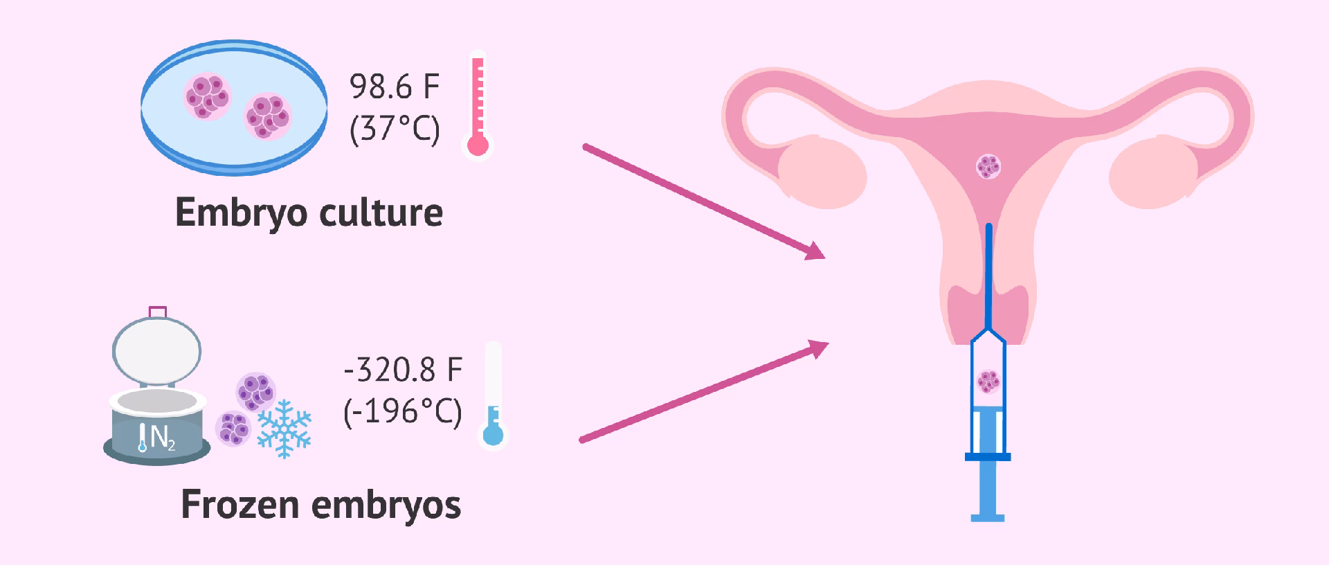 How do I Make my embryo transfer a success?