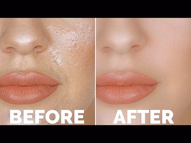 Can you have dry and oily skin?