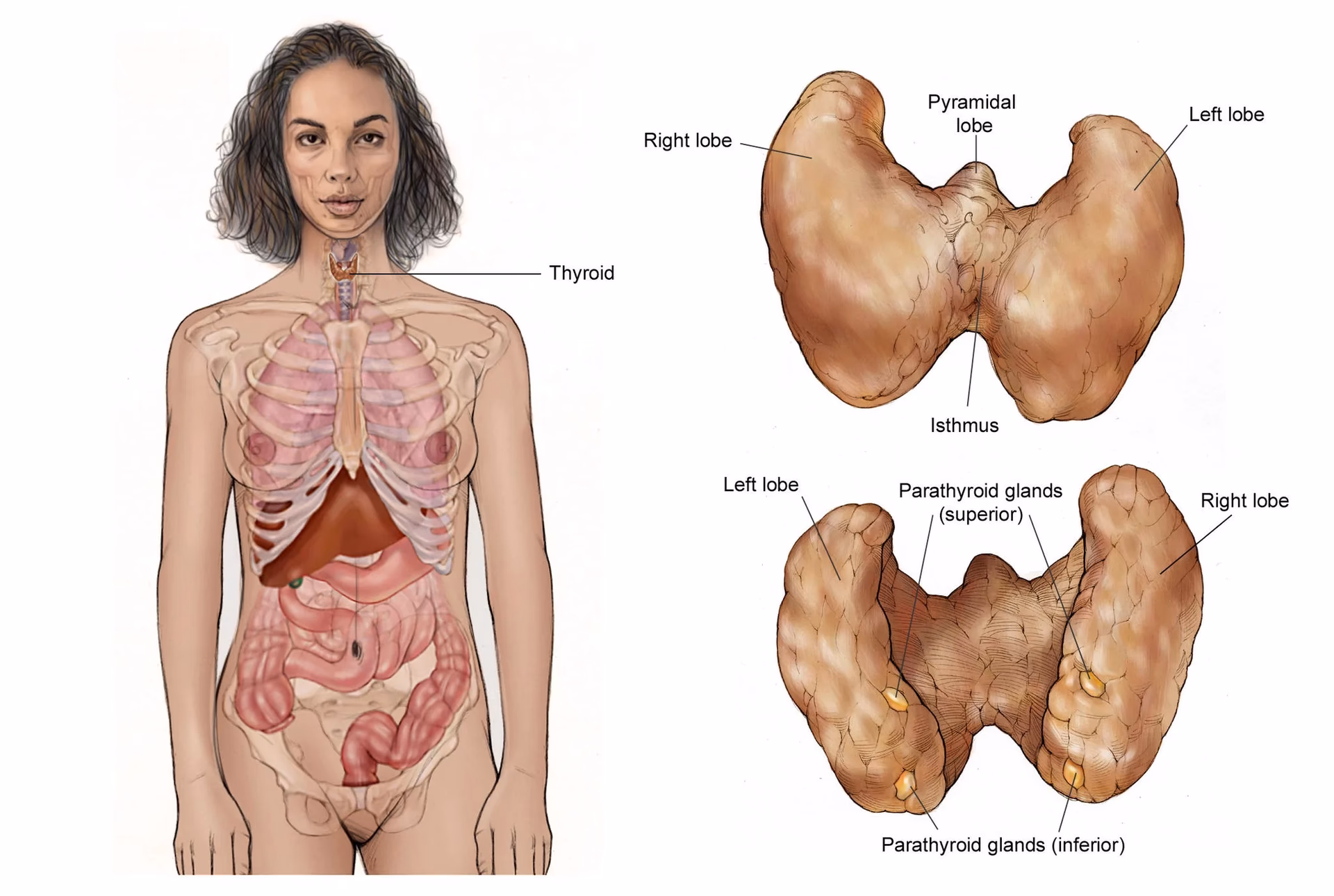 How are benign thyroid nodules treated?